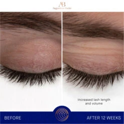 Augustinus Bader The Eyebrow & Lash Enhancing Serum -Christophe Robin Shop p 550x550 1065