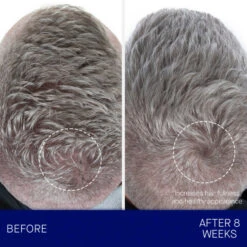 Augustinus Bader The Conditioner -Christophe Robin Shop p 550x550 494